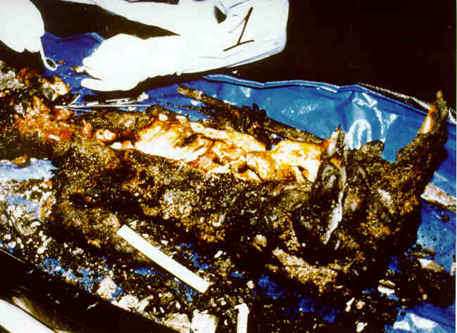 Autopsy photo of Raymond Friesen