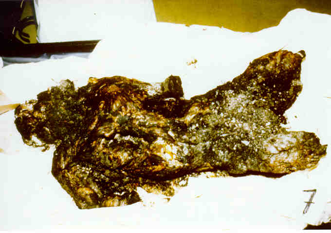 Autopsy photo of Steven Emil Schneider