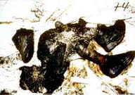 Melissa Morrison autopsy photograph