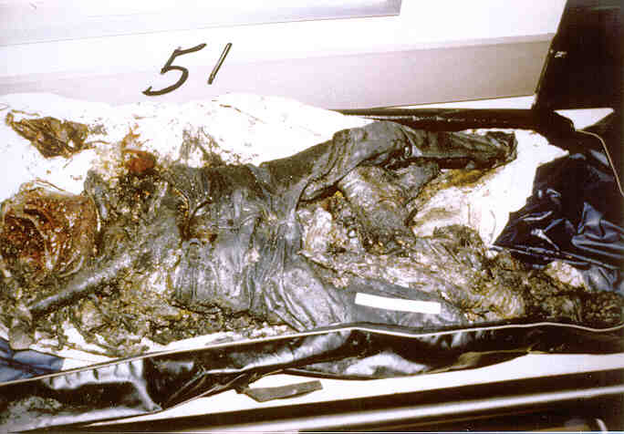 Autopsy photo of Judy V. Schneider